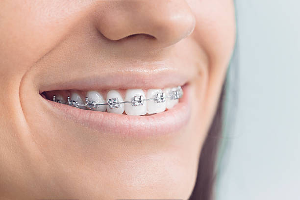 Laser Dentistry in Northgate, OH