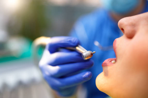 Best Wisdom Tooth Removal  in Northgate, OH